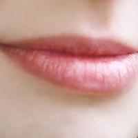 Patologie di bocca e labbra